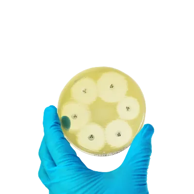 Sepsis Nedir? Belirtileri ve Tedavi Yöntemleri Neledir?