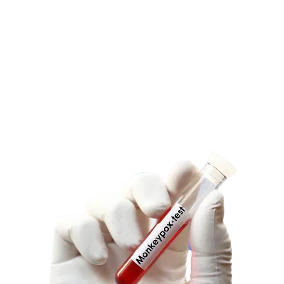 Maymun Çiçeği Virüsü (Monkeypox) Yeni Bir Tehdit mi?