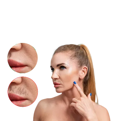Hirsutizm Nedir? Kadınlarda Hirsutizm Nedenleri Nelerdir?