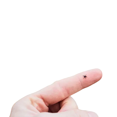 Kene Isırması ve Kırım Kongo Kanamalı Ateşi Nedir?